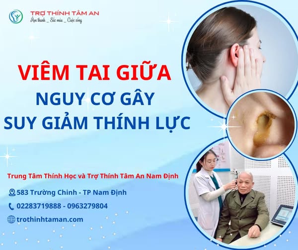 Viêm tai giữa nguy cơ suy giảm thính lực