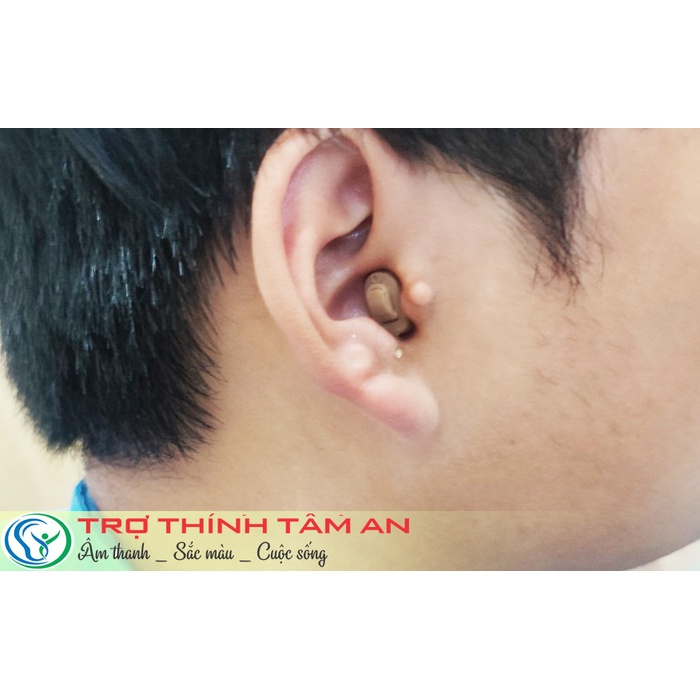 Insio 2NX CIC - Giải pháp trợ thính kín đáo cho người yêu sự tinh tế