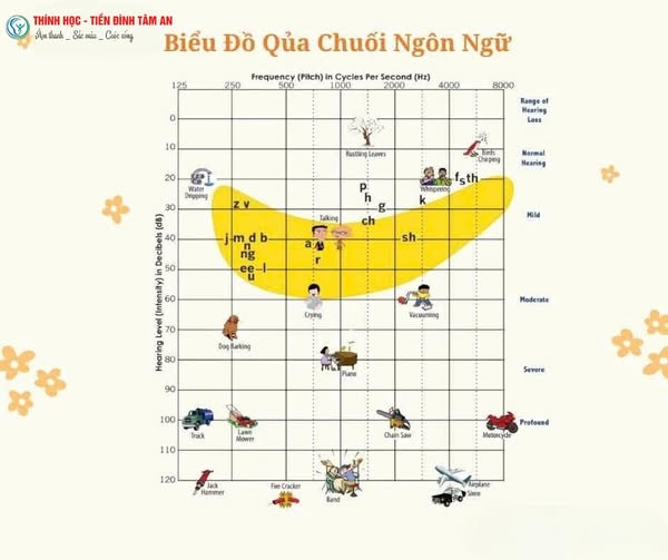 Tìm hiểu về vùng “quả chuối ngôn ngữ” (