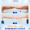 Tay Thon – Nách Gọn: Bí Quyết Diện Đồ Đẹp Không Cần Che Giấu