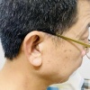 Lắp đặt máy trong tai thẩm mỹ cho bác khách ở Văn Giang – Hưng yên