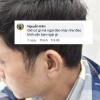 ĐEO MÁY TRỢ THÍNH CŨNG NHƯ ĐEO KÍNH CẬN
