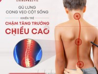 Nắn chỉnh cột sống và giải phẫu đốt sống thắt lưng