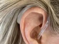 Máy trợ thính Phonak Naida L70-UP – Công nghệ Thụy Sĩ cho thính lực nặng