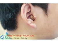 Insio 2NX CIC - Giải pháp trợ thính kín đáo cho người yêu sự tinh tế