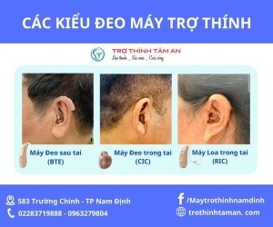 Các kiểu deo máy trợ thính tại Trợ Thính Tâm An Nam Định