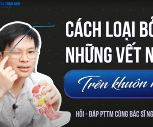 Tiêm botox giảm nếp nhăn