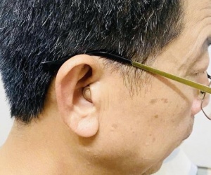 Lắp đặt máy trong tai thẩm mỹ cho bác khách ở Văn Giang – Hưng yên