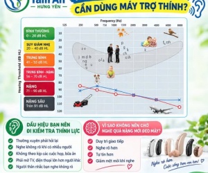 Mức độ suy giảm thính lực nào cần dung máy trợ thính?